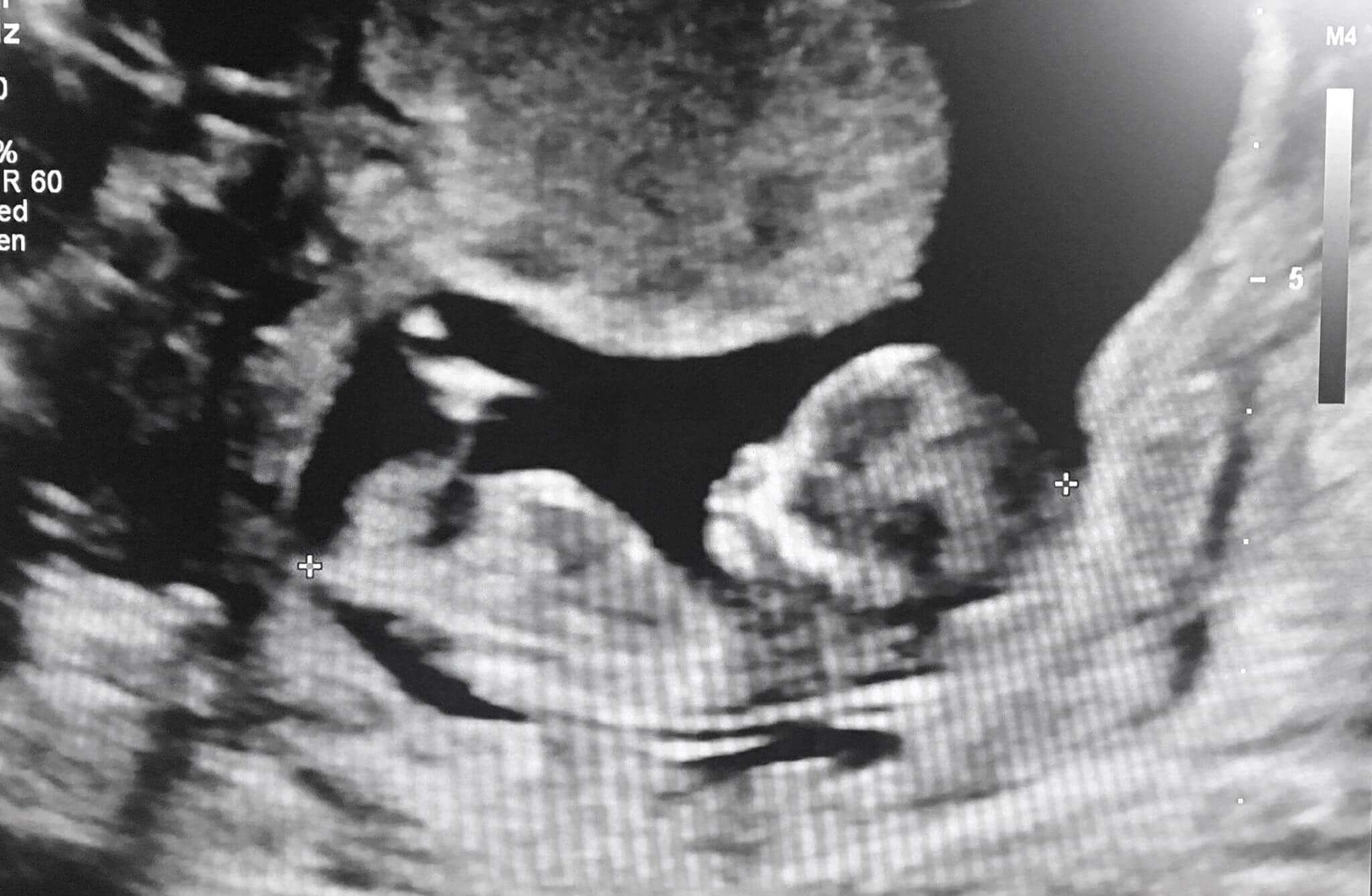 Baby on Board